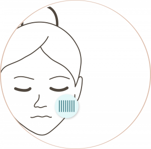 Microneedling Berlin Friedrichshain